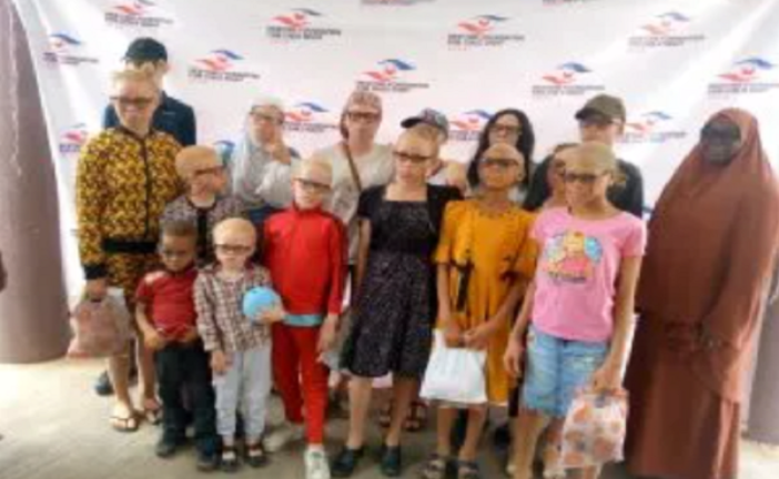 101 Glasses for Children With Albinism