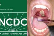 NCDC Reports 111 Confirmed Cases, 22 Deaths Of Diphtheria