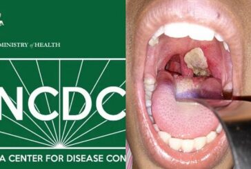 NCDC Reports 111 Confirmed Cases, 22 Deaths Of Diphtheria