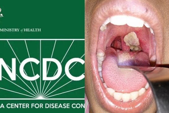 NCDC Reports 111 Confirmed Cases, 22 Deaths Of Diphtheria