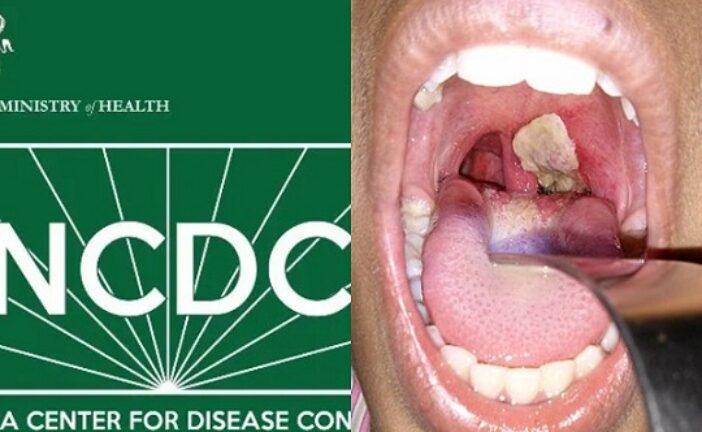 NCDC Reports 111 Confirmed Cases, 22 Deaths Of Diphtheria