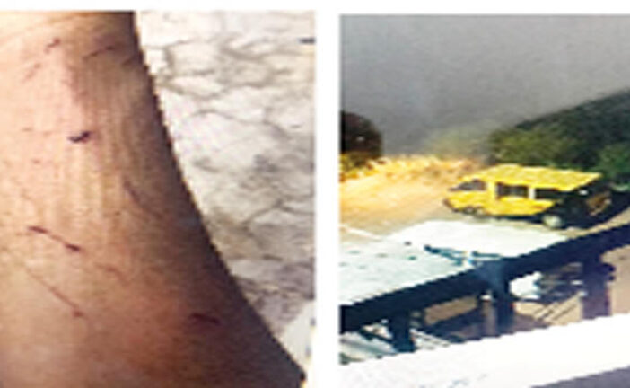 Police Invade Hostel, Brutalise UNIZIK Female Student While Naked