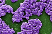 Anthrax: Lagos Destroys Six Infected Animals