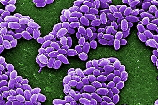 Anthrax: Lagos Destroys Six Infected Animals
