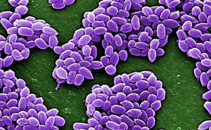 Anthrax: Lagos Destroys Six Infected Animals