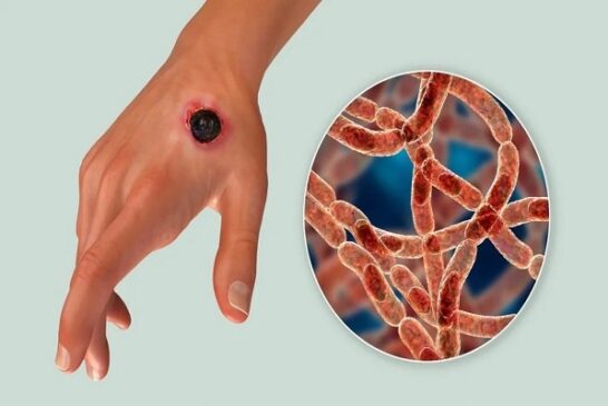 Fed Govt Donates Anthrax Vaccine To Lagos Govt