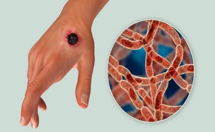Fed Govt Donates Anthrax Vaccine To Lagos Govt
