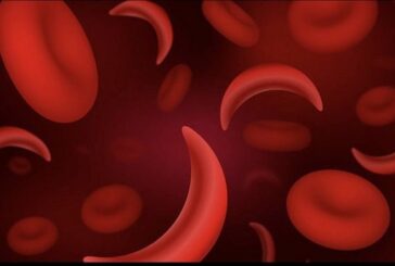 US Approves First Gene-Editing Treatment For Sickle Cell Patients