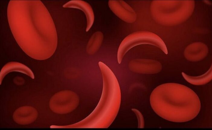 US Approves First Gene-Editing Treatment For Sickle Cell Patients