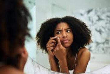 The Causes Of Hyperpigmentation And How To Get Rid Of It