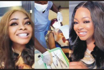 Nollywood Actress, Funmi Awelewa Undergoes Veneer Surgery to get Brand New Teeth