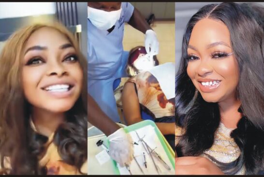 Nollywood Actress, Funmi Awelewa Undergoes Veneer Surgery to get Brand New Teeth