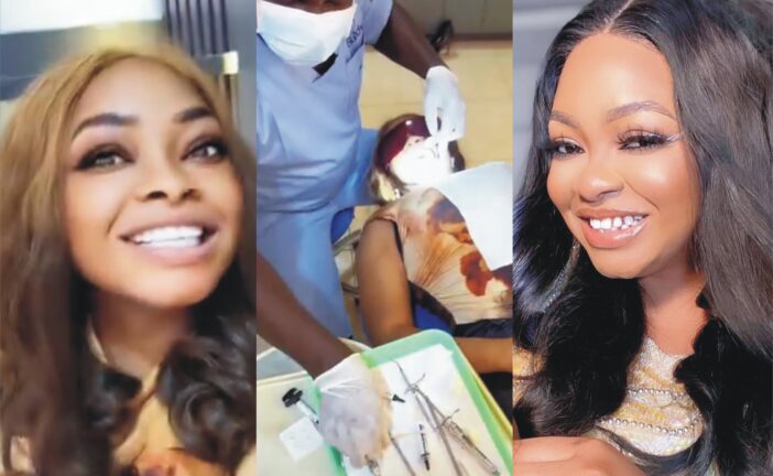Nollywood Actress, Funmi Awelewa Undergoes Veneer Surgery to get Brand New Teeth
