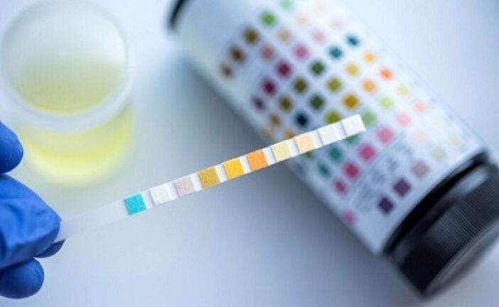 Fed Govt Makes Drug Test Compulsory For Public Service Job Seekers