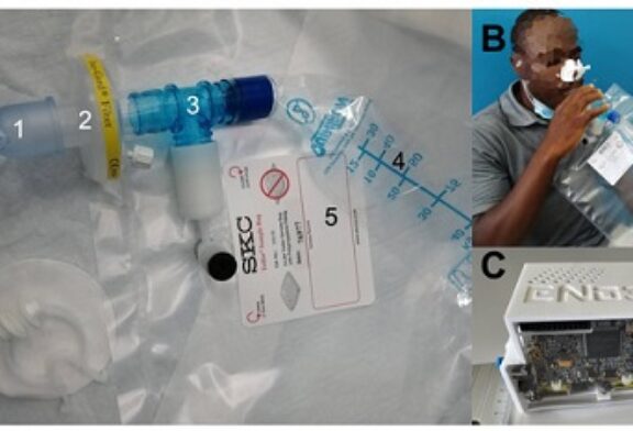 Scientists Develop New Device That Can Detect Infectious Tuberculosis Directly In Exhaled Air