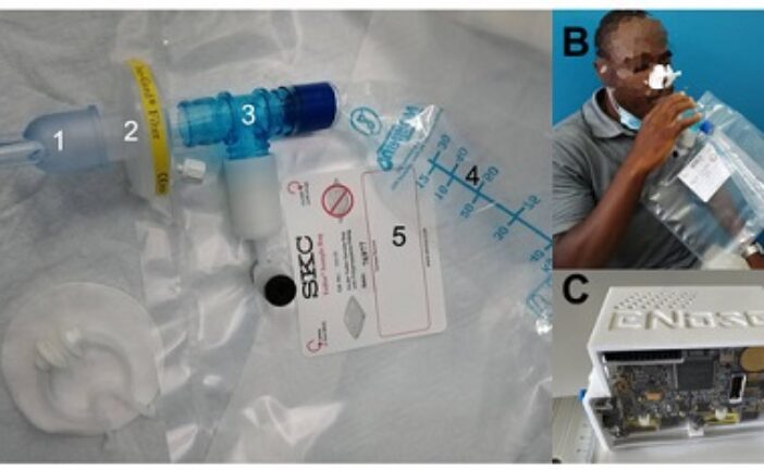 Scientists Develop New Device That Can Detect Infectious Tuberculosis Directly In Exhaled Air